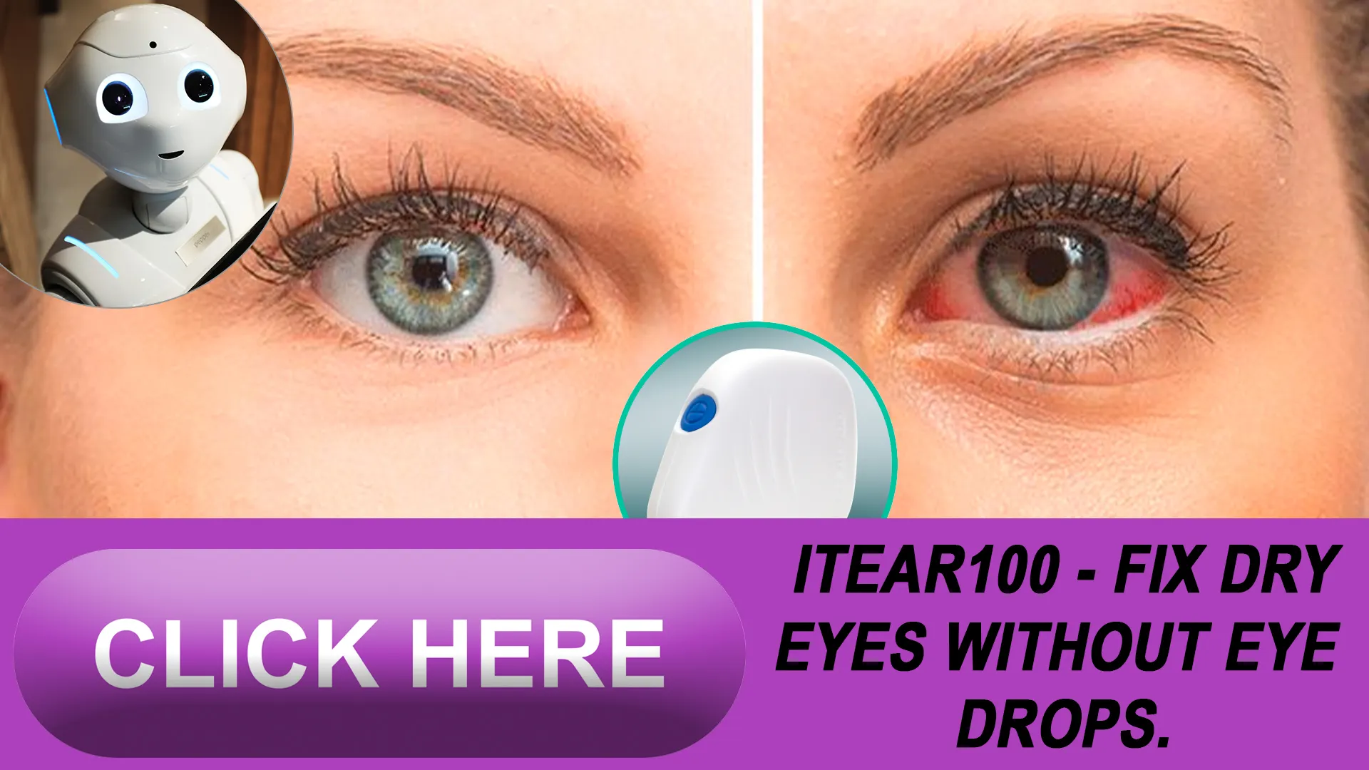 Strategies for Managing Dry Eye at Home